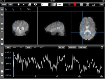 Time-series