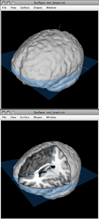 Surface