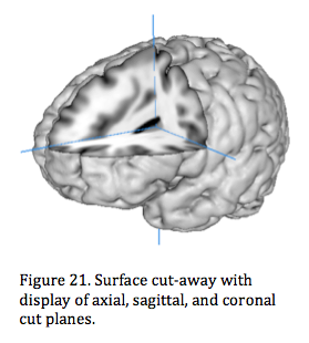 Figure 21