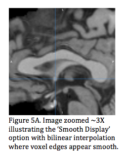 Figure 5a