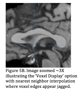 Figure 5b